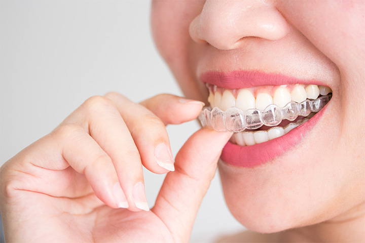 Woman smiling while putting on clear aligner.
